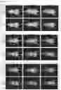 Fig. 17 - EGFR-binding agents and uses thereof