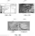 Fig. 16 - BIOREACTOR MODULE, A BIOREACTOR SYSTEM AND METHODS FOR THICK TISSUE SEEDING AND CULTIVATION IN AN HIERARCHICAL ORGANIZATION AND PHYSIOLOGICAL MIMICKING CONDITIONS