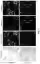 Fig. 11 - Devices and methods for isolating a migratory cell population
