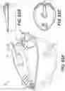 Fig. 65 - Systems and methods for medical device control