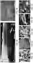 Fig. 06 - Generation of human spinal cord neural stem cells