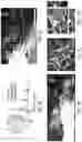 Fig. 11 - Generation of human spinal cord neural stem cells
