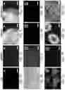 Fig. 14 - Generation of human spinal cord neural stem cells
