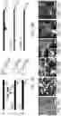Fig. 20 - Generation of human spinal cord neural stem cells