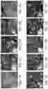 Fig. 29 - Generation of human spinal cord neural stem cells