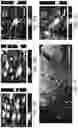 Fig. 35 - Generation of human spinal cord neural stem cells