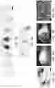 Fig. 37 - Generation of human spinal cord neural stem cells