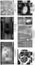 Fig. 41 - Generation of human spinal cord neural stem cells