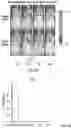 Fig. 77 - METHODS FOR ISOLATING, EXPANDING AND ADMINISTERING CANCER SPECIFIC CD8+ T CELLS