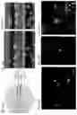 Fig. 17 - Advanced pulmonary models