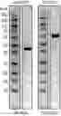 Fig. 01 - Enzymes for Glycan Analysis