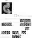 Fig. 07 - Targeting BCL11A distal regulatory elements for fetal hemoglobin reinduction