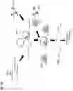 Fig. 11 - CAPTURE OF NUCLEIC ACIDS USING A NUCLEIC ACID-GUIDED NUCLEASE-BASED SYSTEM