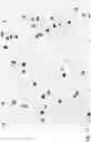 Fig. 17 - Method for obtaining nucleic acid derived from fetal cell