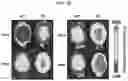 Fig. 17 - Probe for measuring activity of Caspase-1 and composition for diagnosis of inflammatory diseases containing same