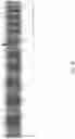 Fig. 17 - METHODS AND PROCESSES FOR ASSESSMENT OF GENETIC MOSAICISM