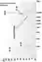 Fig. 11 - Method for attaching one or more polynucleotide binding proteins to a target polynucleotide