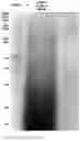 Fig. 11 - Lactic acid bacteria and its applications