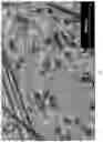 Fig. 09 - High carbon content cobalt-based alloy