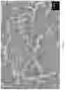 Fig. 19 - High carbon content cobalt-based alloy