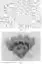 Fig. 28 - High carbon content cobalt-based alloy