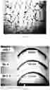 Fig. 02 - High-strength aluminium-based alloy