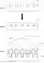 Fig. 01 - Preparing method of tightly sealed 3D lipid structure and tightly sealed 3D lipid structure prepared thereby