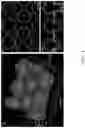 Fig. 07 - Preparing method of tightly sealed 3D lipid structure and tightly sealed 3D lipid structure prepared thereby