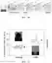 Fig. 11 - Preparing method of tightly sealed 3D lipid structure and tightly sealed 3D lipid structure prepared thereby