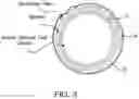 Fig. 04 - Three dimensional printing modality combining fused deposition modeling and electrospinning
