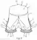 Fig. 04 - Intake system for an internal combustion engine, in particular of a motor vehicle