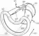 Fig. 01 - Ported shroud system for turboprop inlets