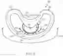 Fig. 07 - Ported shroud system for turboprop inlets