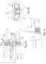 Fig. 06 - GAS TURBINE ENGINE FOR AN AIRCRAFT WITH AN ENGINE SHAFT