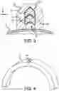 Fig. 03 - Thermally initiated variable venting system for rocket motor