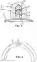 Fig. 04 - Thermally initiated variable venting system for rocket motor