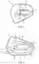 Fig. 03 - FUEL STRAINER