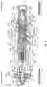 Fig. 05 - Electrohydraulic valve normally operating in fluid flow-blocking mode and configured to operate in pressure relief mode when actuated