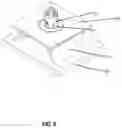Fig. 09 - Fastener clip assembly with a dome and limiters