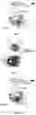 Fig. 05 - Automatic slack adjuster
