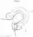 Fig. 06 - Pendulum-type accessary tensioner