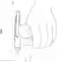 Fig. 05 - Trigger-actuated grease applicator