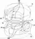 Fig. 01 - Flow restricting fluid component