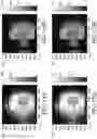 Fig. 10 - Polarization change detection
