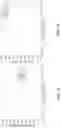 Fig. 14 - Simultaneous real-time measurement of composition, flow, attenuation, density, and pipe-wallthickness in multiphase fluids