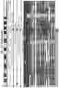 Fig. 91 - Signatures and determinants for diagnosing infections and methods of use thereof