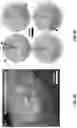 Fig. 06 - Epidermal microfluidic sensor for sweat collection and analysis from aquatic athletes