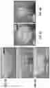Fig. 09 - Epidermal microfluidic sensor for sweat collection and analysis from aquatic athletes
