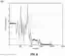 Fig. 11 - Real-time accelerometer calibration