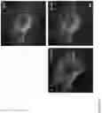 Fig. 04 - A SYSTEM AND METHOD FOR MICROSCOPY
